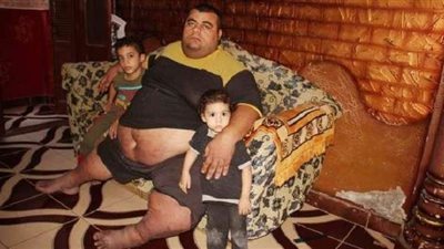 الرئيس الإنسان .. السيسي يتواصل مع الجميع.. يتجاوب مع مشاكل المواطن البسيط.. يوجه بعلاج مواطن يعانى من السمنة المفرطة على نفقة الدولة