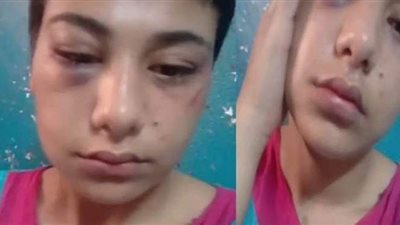 عامل الفندق في تحقيقات قضية منة عبد العزيز: ليس لي علاقة بالمتهمين.. أحدهم تشاجر مع أمن الفندق.. وأجبروني على الإنفاق عليهم