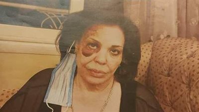 نجلة عم الفنانة ماجدة الصباحي تتعرض لسرقة مجوهراتها بالإكراه على يد خادمتها | صور