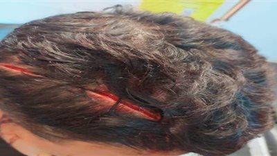 حبس المتهمين بالتعدي على شاب بسلاح لسرقته  في الغربية