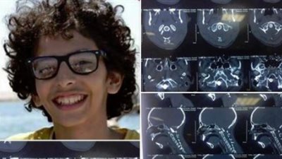 نشطاء «فيس بوك» يطالبون بإنقاذ الطفل يوسف المصاب بطلقة طائشة في المخ