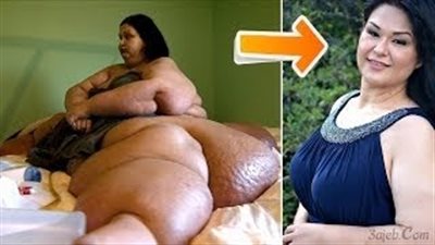 بالفيديو.. أسمن وأثقل 10 أشخاص بدانة في العالم