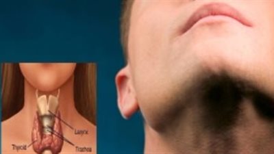 5 أطعمة ضرورية لمريض فرط نشاط الغدة الدرقية