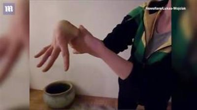 بالفيديو والصور.. رجل يثير ضجة بقدرته على ثني يده 360 درجة