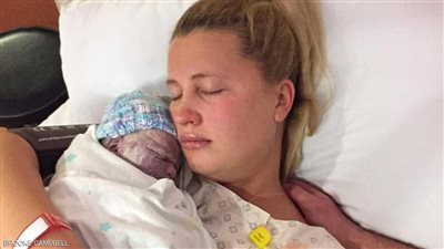 أسترالية تصر على التقاط صورة مع جنينها رغم ولادته ميتا