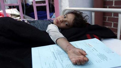 «الدفتيريا» تقتل 73 يمنيا منذ أغسطس الماضي