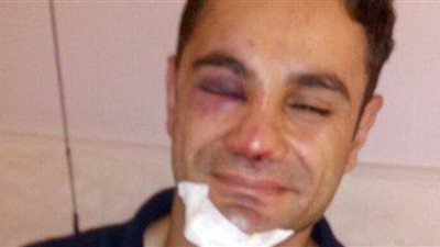 حجز 5 بودي جاردات للتحريات بعد تعديهم على ضابط في حفل «حماقي»