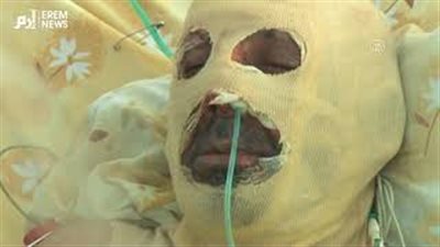 لاجئ سوري يحرق نفسه بسبب الفقر في لبنان (فيديو)