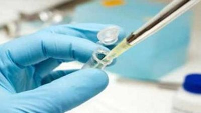 أعراض وأخطار ارتفاع هرمون الحليب في الدم لدى الرجال والنساء