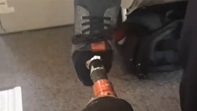 بالفيديو.. شركة طيران تطلب من معاق إثبات تركيبه قدما صناعية