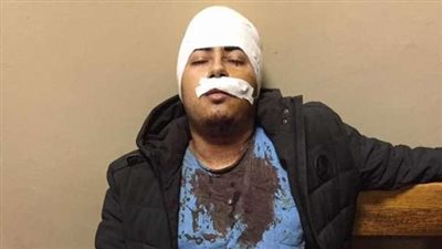 إسلام حاتم ضحية جديدة لـ«أوليكس» (صور)