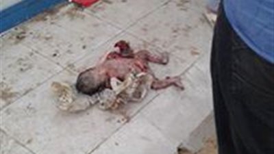 بالفيديو..العثور على جثة رضيعة في أكوام القمامة بالدقهلية