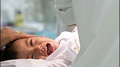 تزايد معدلات «الختان» في أستراليا رغم حظره بالمستشفيات