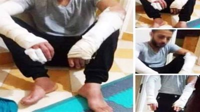 بيبيع أرخص مننا.. تفاصيل إشعال النيران في تاجر على يد سيدة وأبنائها الستة بالغربية