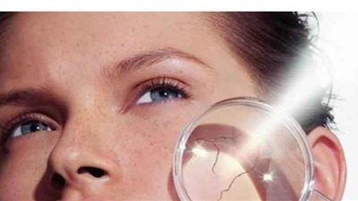 أفضل وأسرع حلول لعلاج حروق الشمس بمواد طبيعية