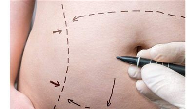 مشروب سحري لحرق الدهون في أسبوعين