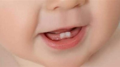 ٤ طرق للعناية بأسنان الأطفال قبل ظهورها الأول لتجنب مشاكلها