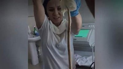 أطباء روس يخرجون أفعى بطول متر من فم 