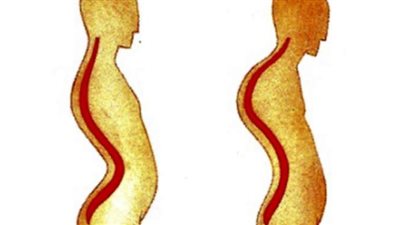 تمارين رياضية تساعد فى علاج انحناءات الظهر | فيديو