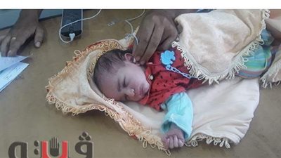 فحص 3910 أطفال بالمنيا ضمن مبادرة السمعيات