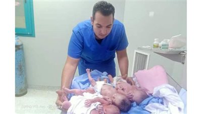 نجاح ولادة قيصرية لـ4 توأم في المستشفى الجامعي بقنا