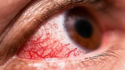 قبل إصابته بالعمى.. أحمد يستغيث لإجراء عملية جراحية بالخارج