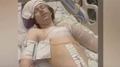 طفل مريض عقليا.. طلبت أمه المساعدة فأطلقت عليه الشرطة النار