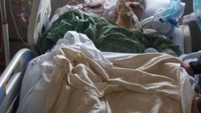 رجل يدخل في غيبوبة بسبب وجبة بيتزا مجانية