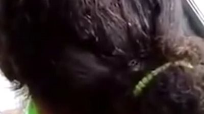 بالفيديو والصور.. «القمل» يغزو رأس امرأة