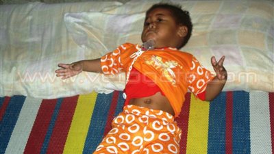 بالصور.. «ضمور المخ والأعصاب» مرض ينهش في جسد «جنى» ابنة سمالوط منذ 4 سنوات.. والدها: «استلفت فلوس بالربا علشان أعالج بنتي دون جدوى».. ووالدتها تناشد وزير الصحة بالتدخل ل