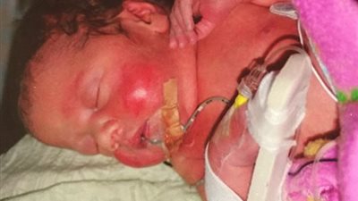 بالصور.. «عفريت» طفل يظهر على كتف شقيقته التوأم