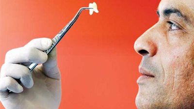 طرق الوقاية من مضاعفات خلع «ضرس العقل»