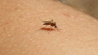 «قشر الموز والشاي والملح».. علاج فعّال لـ«لسعات الحشرات الصيفية»