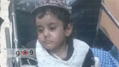 بالصور.. تعذيب طفلة بطريقة وحشية على يد زوجة أبيها