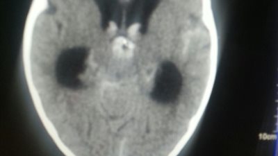 بالفيديو والصور.. أب يستغيث بالمسئولين لإنقاذ ابنه من الموت