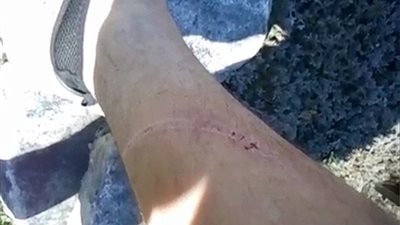 بالفيديو والصور.. إصابة رجل بسبب لهوه بسوط كبير