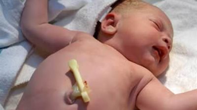 نصائح للتعامل مع سرة الطفل حديث الوﻻدة