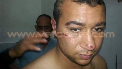 بالصور.. ربة منزل تستعين ببلطجي لتأديب نجلها في الشرقية