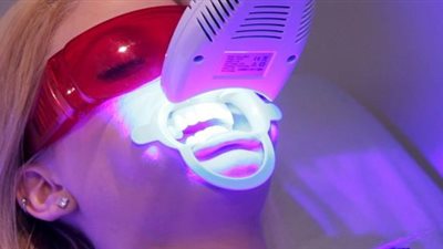 4 أضرار يسببها تبييض الأسنان بالليزر