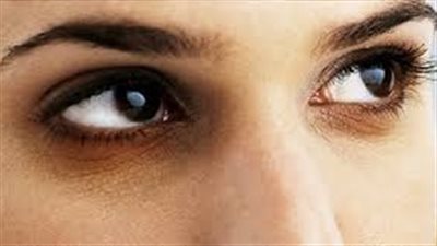 سباعية منزلية لعلاج «هالات العين» السوداء
