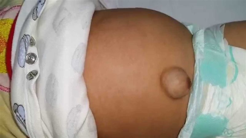 صورة تعبيرية 