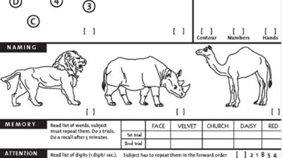 «سي إن إن» تعرض صورة لاختبار القدرات العقلية لترامب