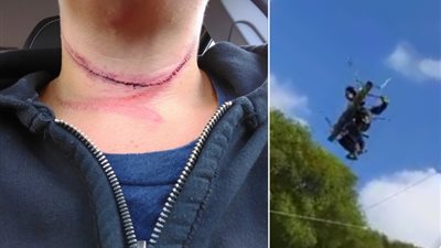 بالفيديو والصور.. امرأة تقطع عنقها أثناء الانزلاق على حبل معلق في الهواء