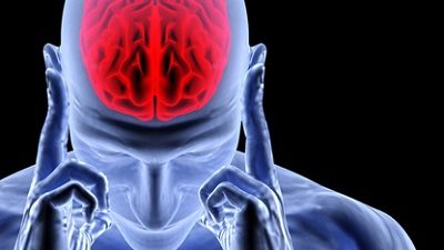 5 علامات تكشف الإصابة بالسكتة الدماغية