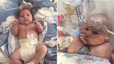 العناية الإلهية تنقذ طفلا بنصف قلب من الموت