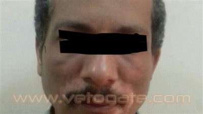 تشريح جثة عجوز قطع نجله رأسه وعضوه الذكري بإمبابة