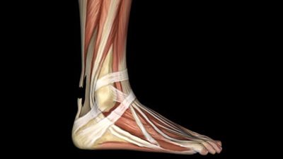 أسباب الإصابة بالتهاب «وتر العرقوب» وطرق العلاج
