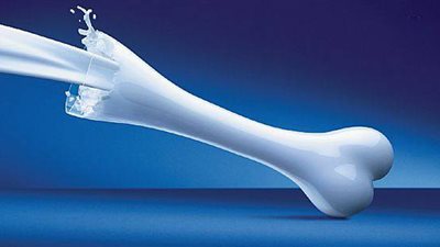 عصير سحرى لتقوية العظام والتخلص من الهشاشة