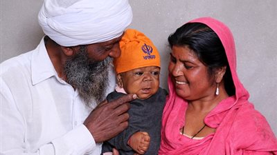 بالفيديو والصور.. حالة غامضة لشاب طوله 58 سم ووزنه 7 كجم