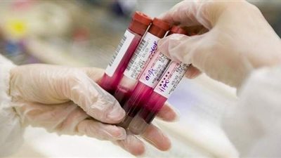 مرض كرونز أعراضه وأسبابه.. التهاب ببطانة الجهاز الهضمي من الفم لفتحة الشرج.. غير معروف أسبابه ولا يوجد له علاج..  وآلام البطن والإسهال أبرز أعراضه